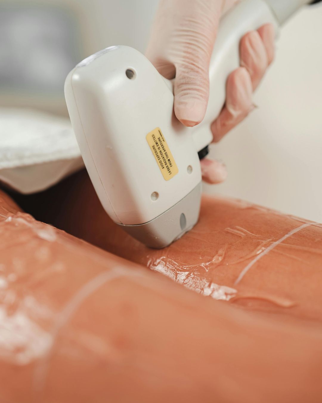 epilation electrolyse a perpignan